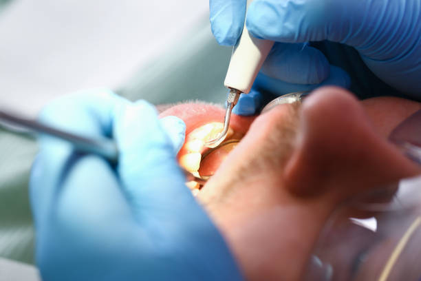 Best Broken Tooth Emergency  in Reinbeck, IA