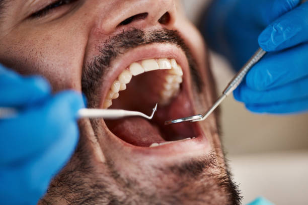 Best Emergency Tooth Extraction  in Reinbeck, IA